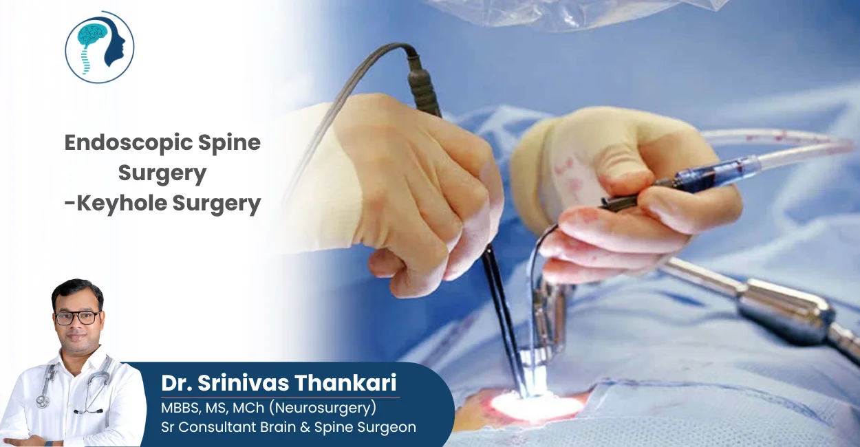 best neurosurgeon in hyderabad - dr srinivas thankari