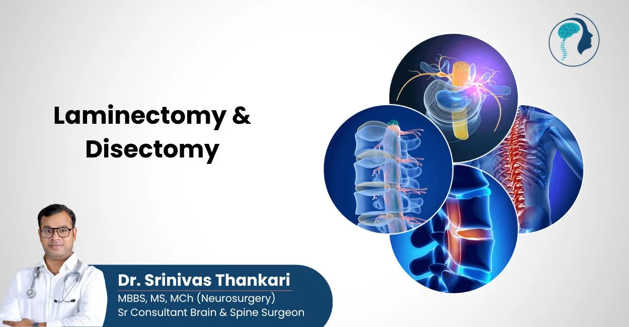 laminectomy & discectomy treatment in Hyderabad - dr srinivas Thankari