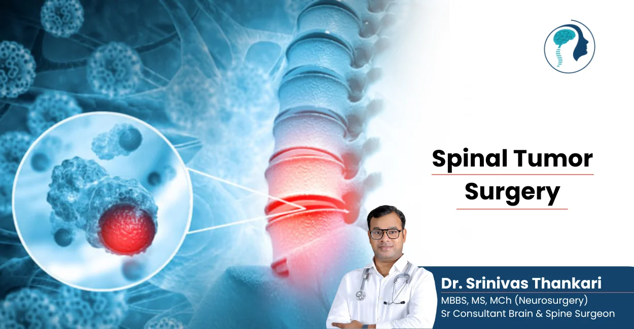 best neurosurgeon in hyderabad - dr srinivas thankari