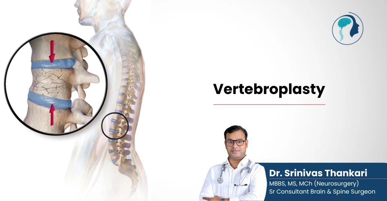 best neurosurgeon in hyderabad - dr srinivas thankari